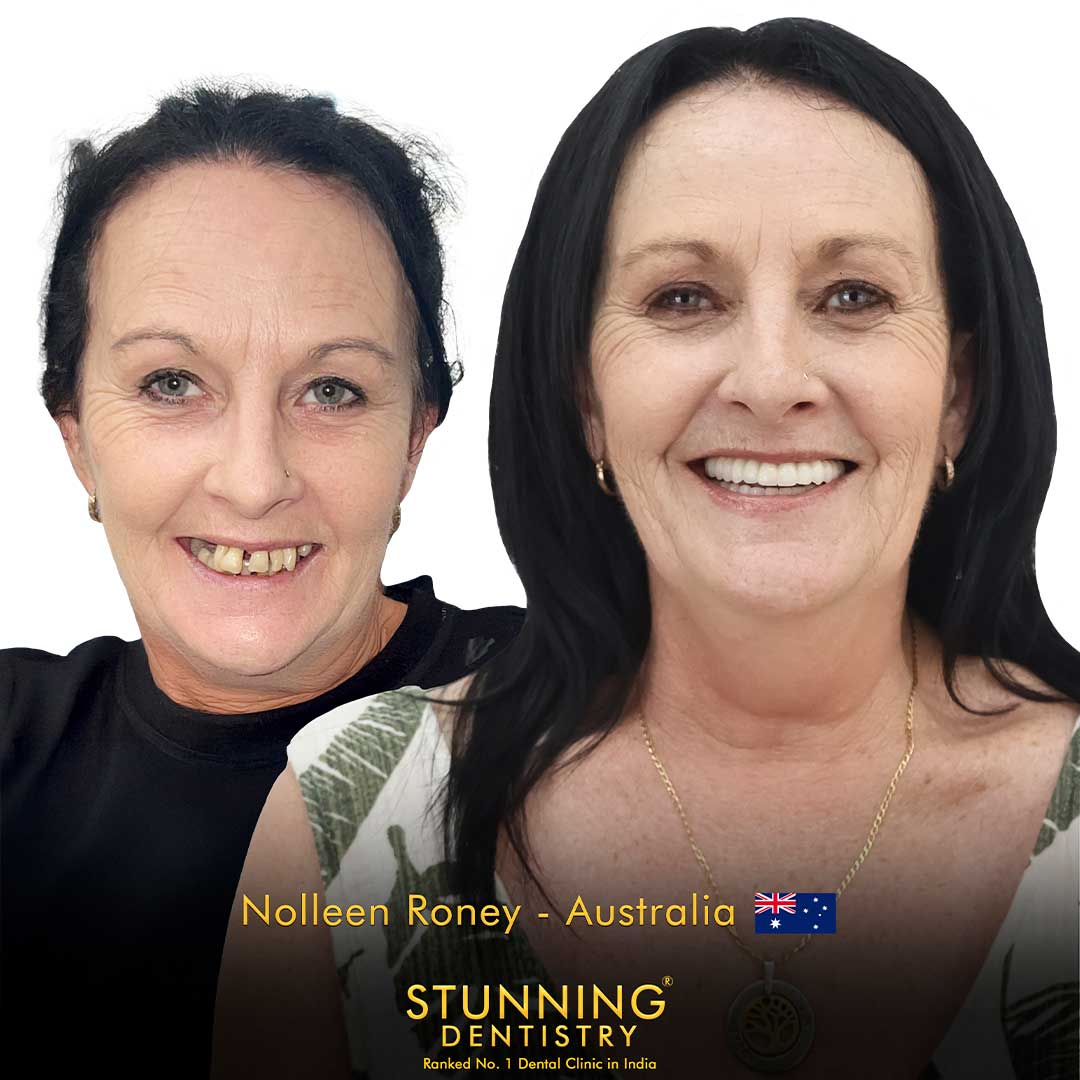 dental doctor near me defence colony