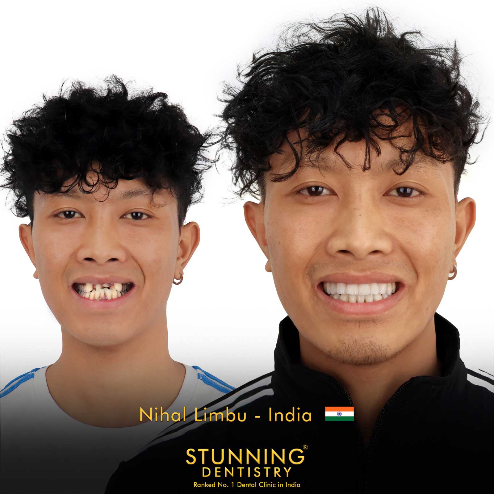Teeth Specialist