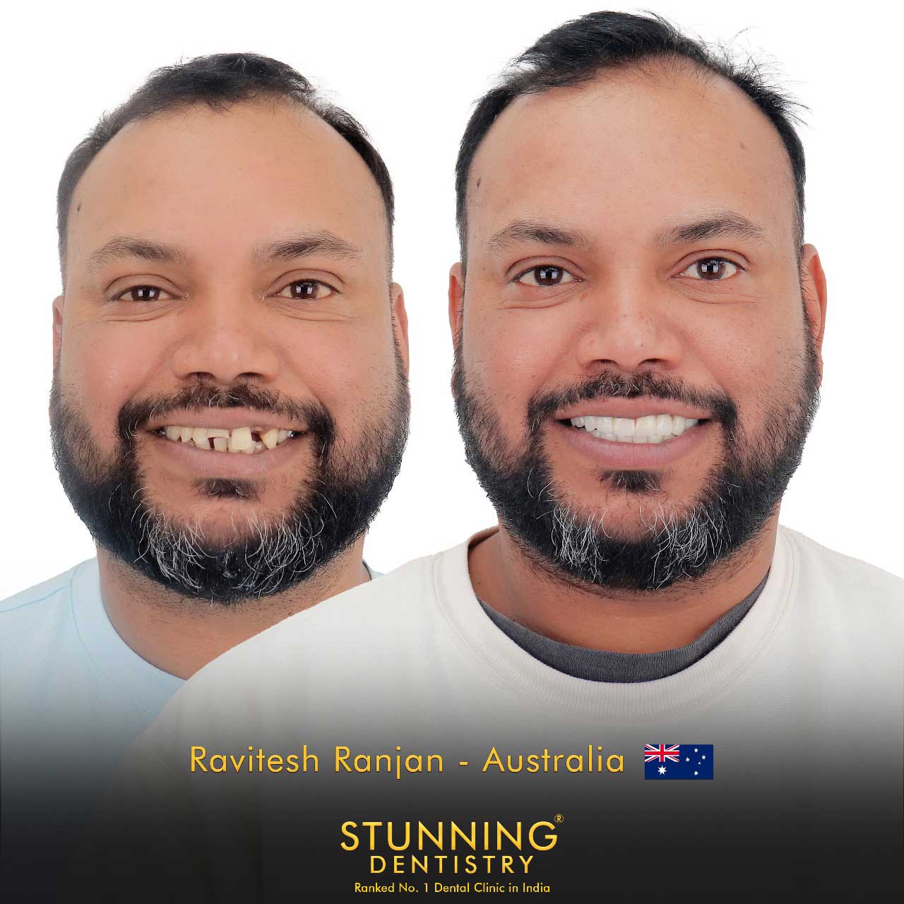 Best Gums Specialist in dentist in safdarjung enclave