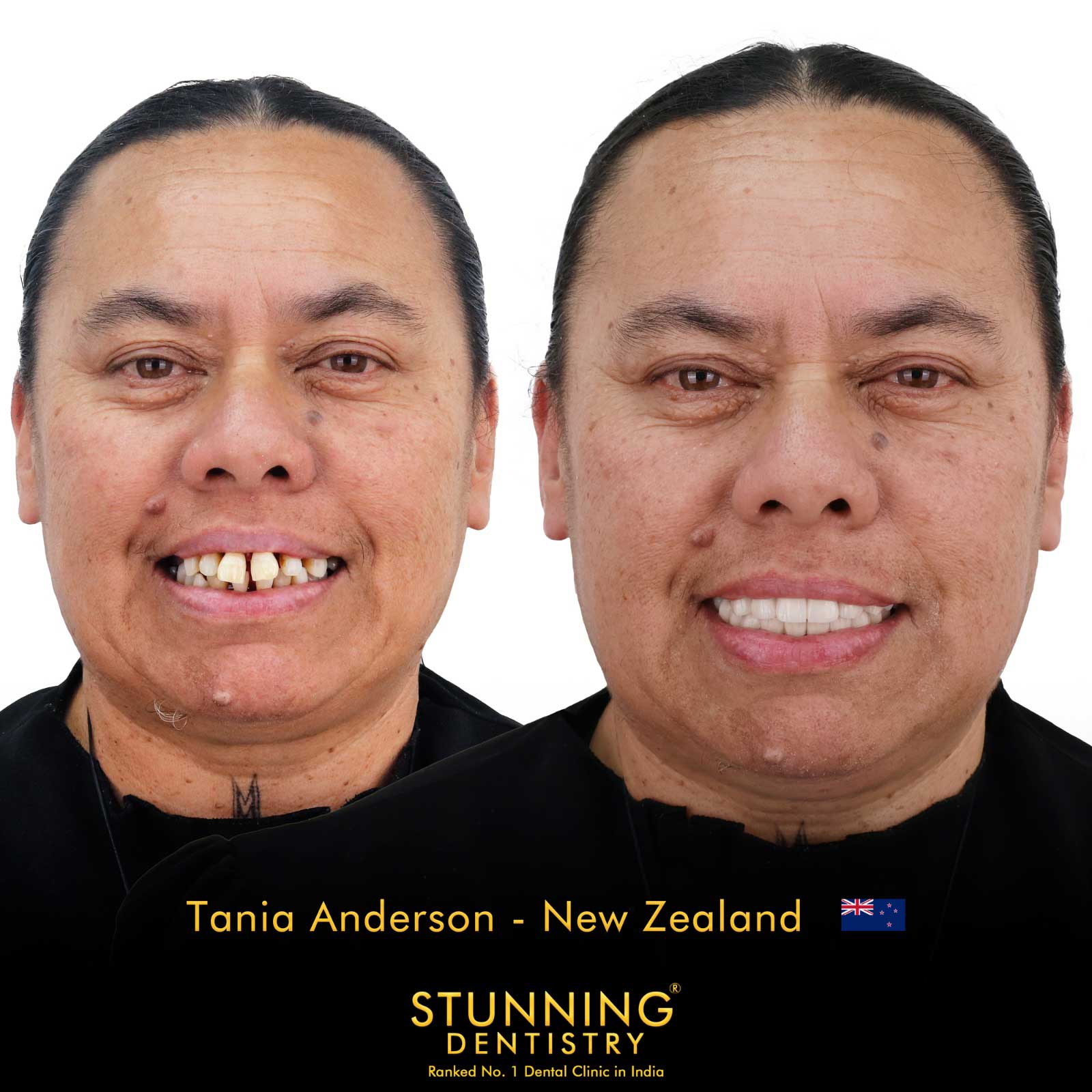 Teeth Specialist