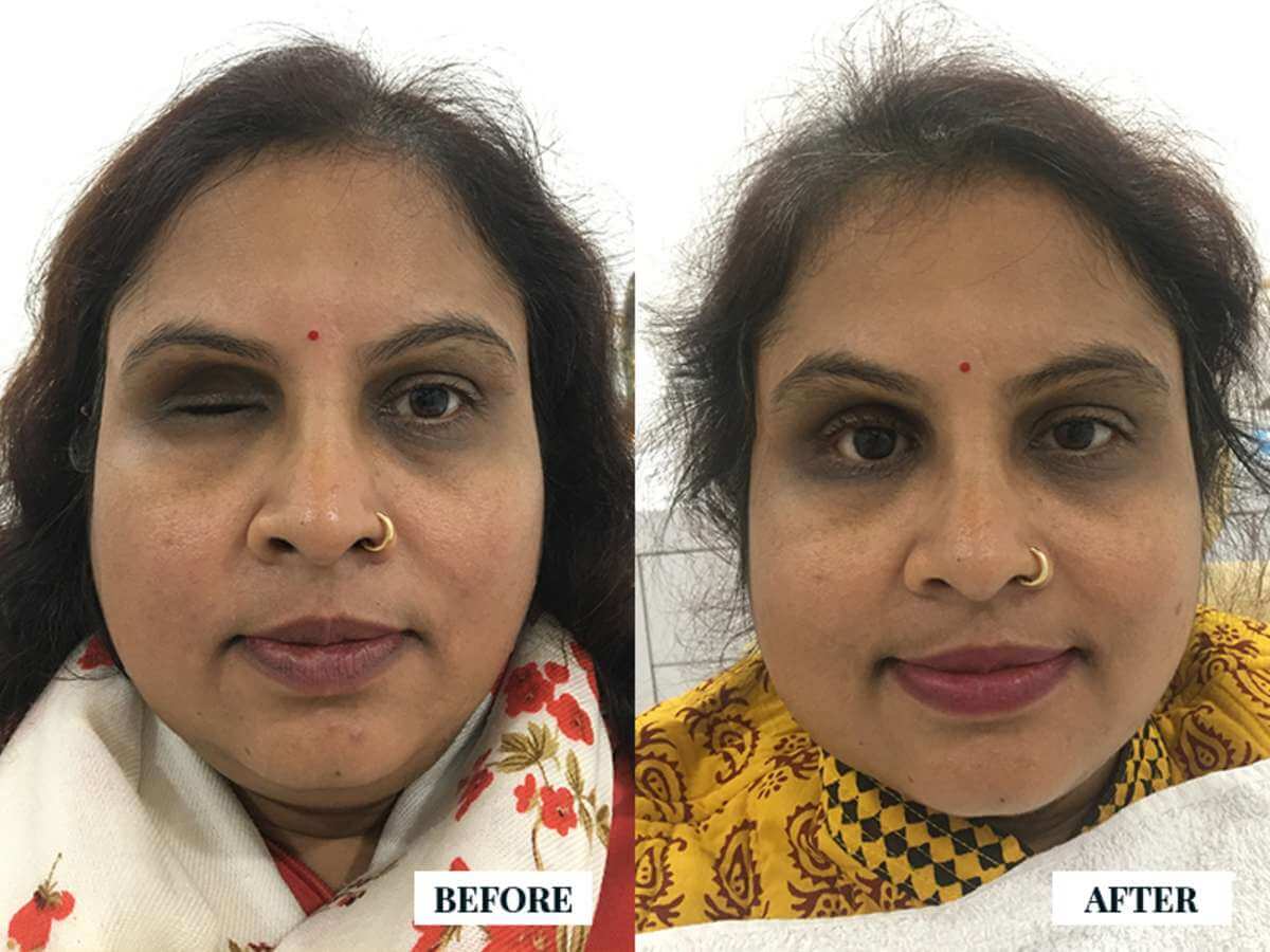 artificial eye clinic