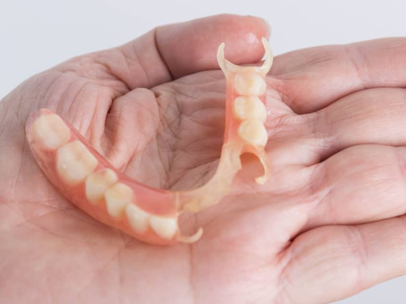 flexible partial denture Procedure