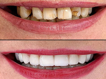 multispeciality dental clinic with cosmetic dentistry in india, best implantologist in delhi