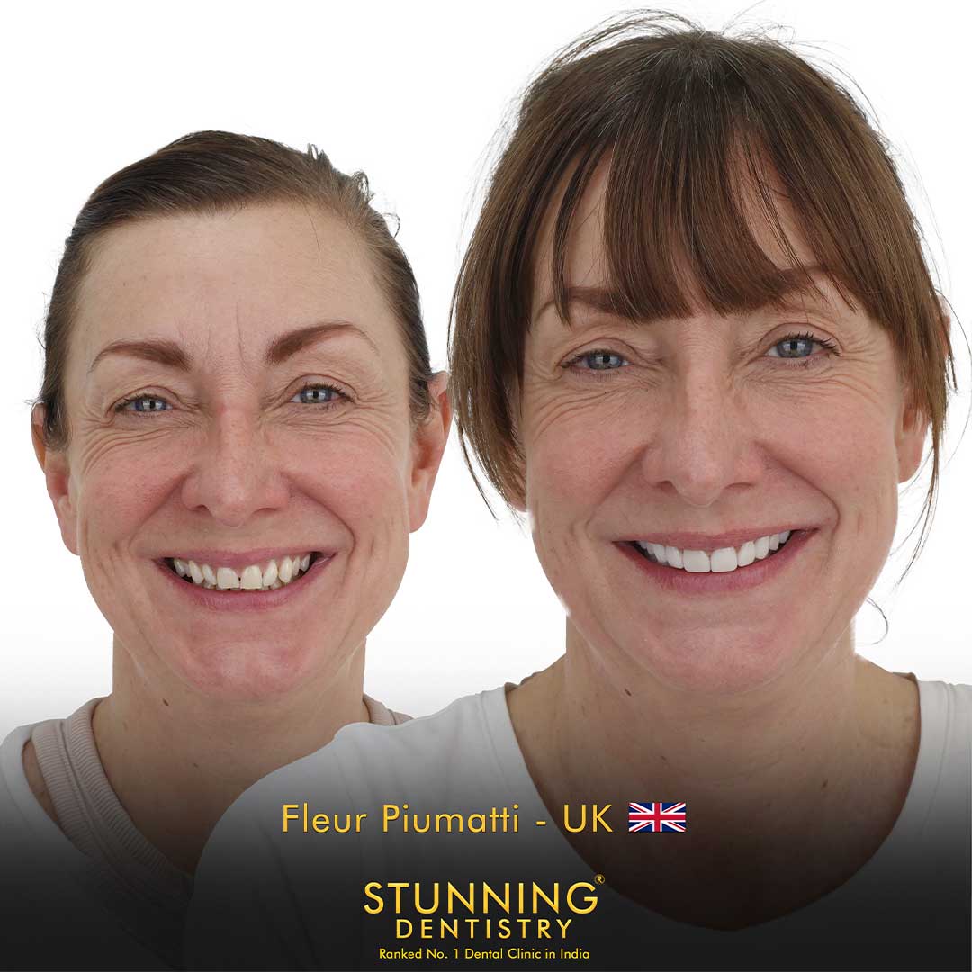 Best Gums Specialist in dentist in safdarjung enclave