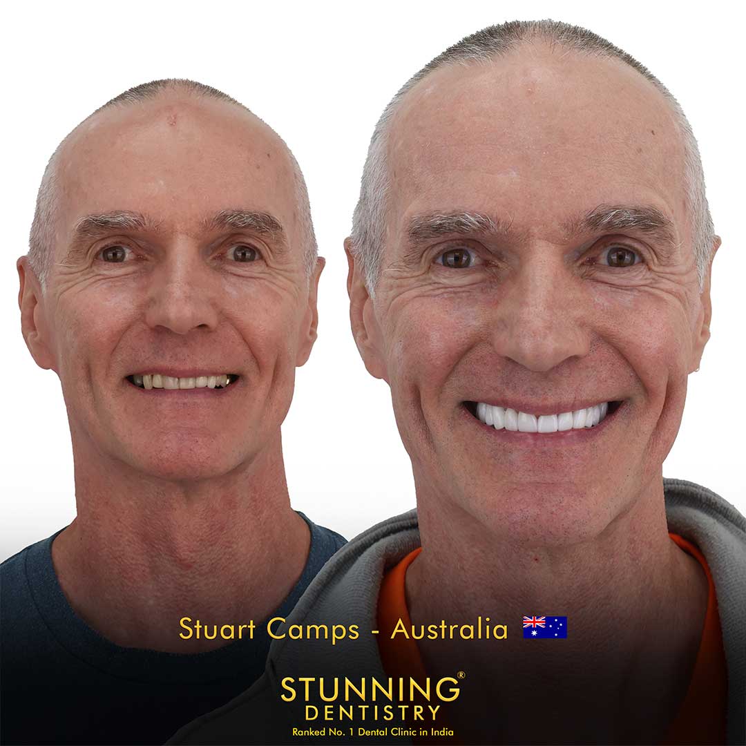Teeth Specialist